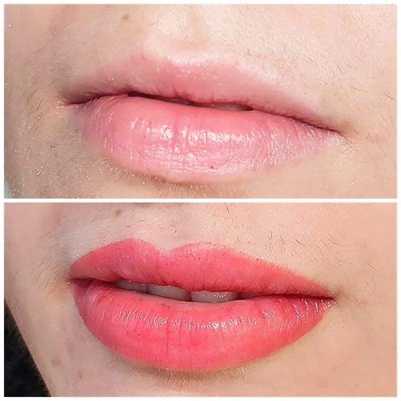 Antes y después, Monika Klara Nagy